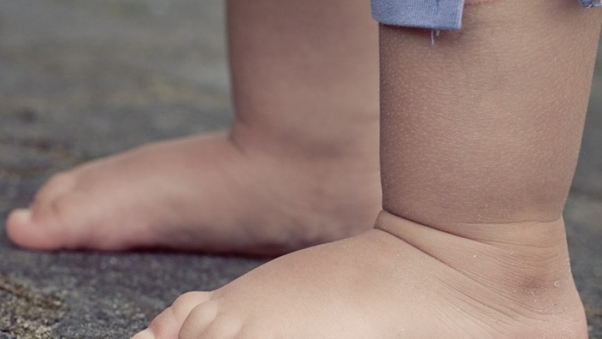 Bose noge – zdrava stopalca