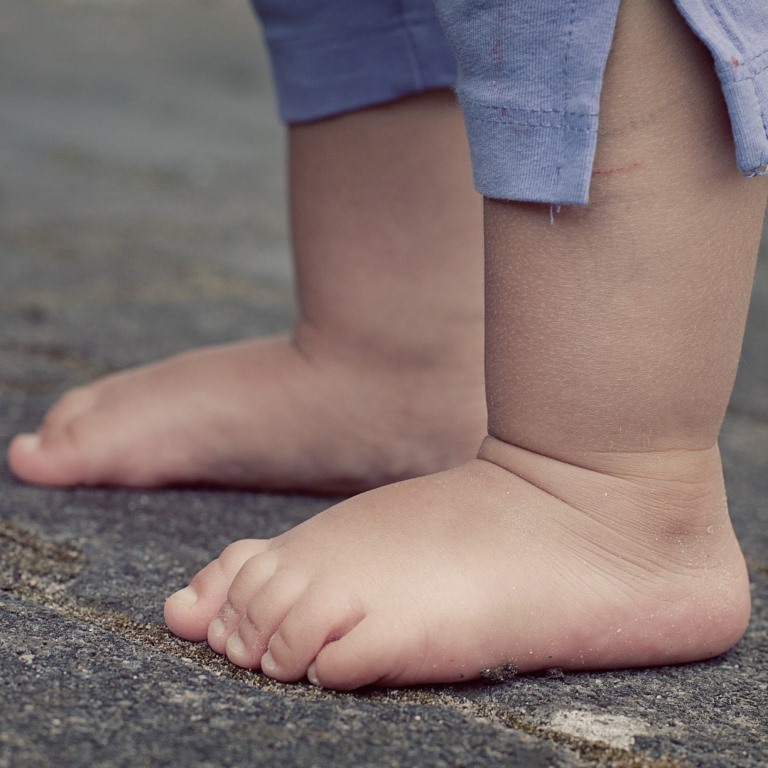 Bose noge – zdrava stopalca